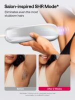 Ulike Laser Hair Removal Device for Women and Men, Air 10 IPL Hair Removal with Sapphire Ice-Cooling, Nearly Painless, Long-lasting Results, SkinSensor, 4 Modes for Body & Face At-Home Use